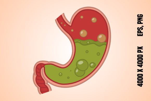 Download Stomach Disease - Disease Collection